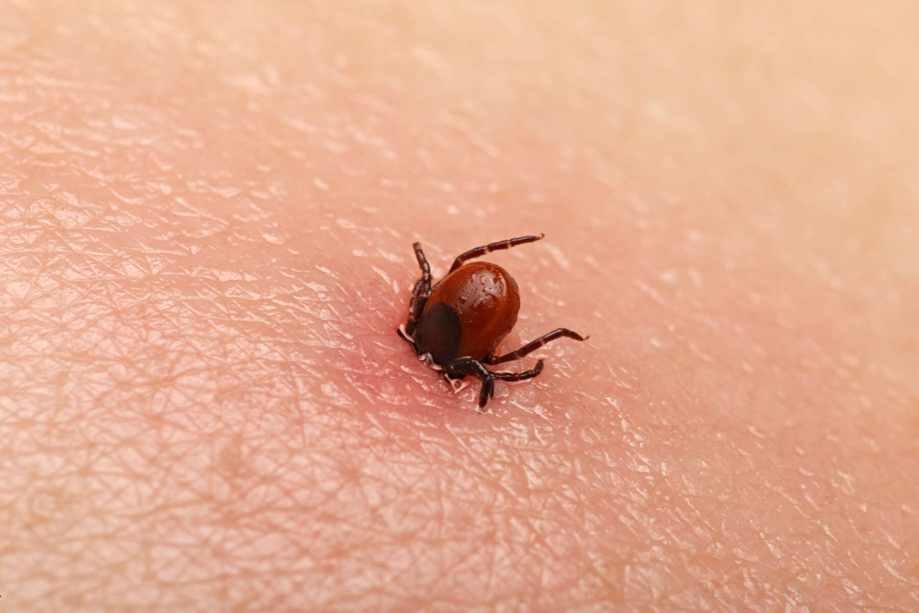 Encephalitis tick