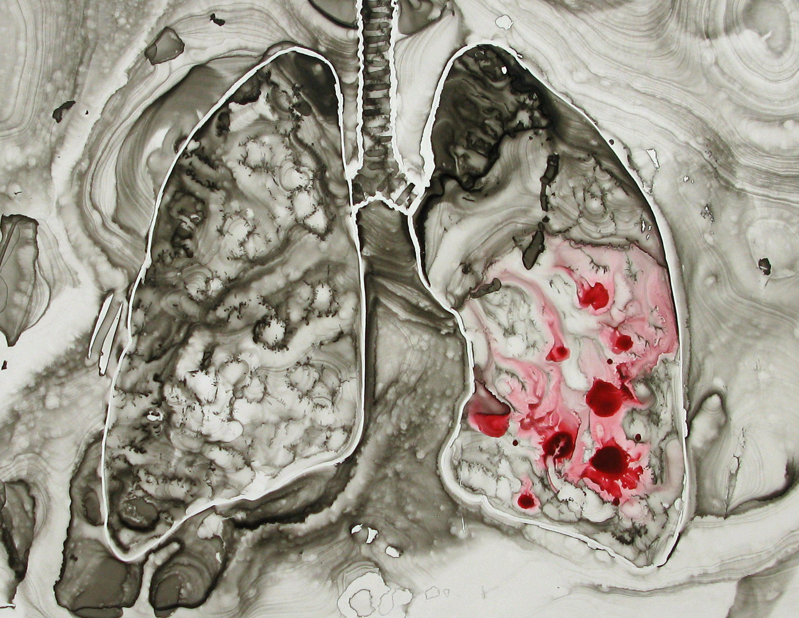 covid lungs ink 2020