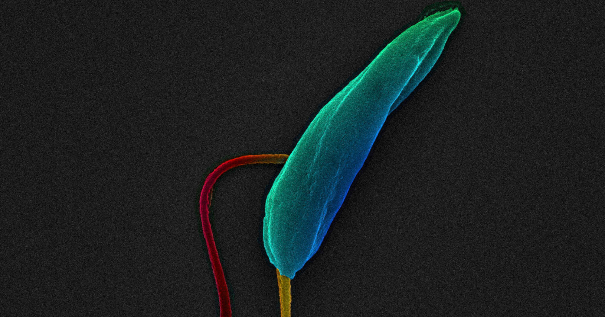 Image of a Leishmania parasite