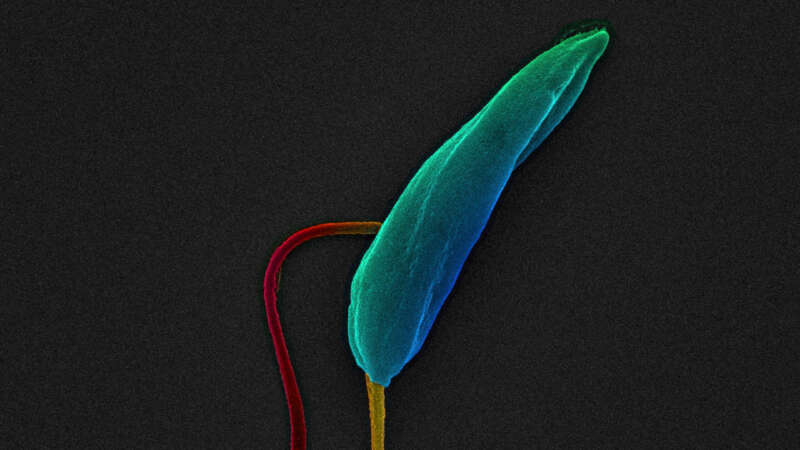 Image of a Leishmania parasite